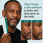 Load image into Gallery viewer, Scar & Acne Repair Cream_KE