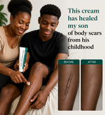 Load image into Gallery viewer, Scar & Acne Repair Cream_KE