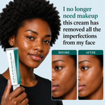 Load image into Gallery viewer, Scar &amp; Acne Repair Cream_KE
